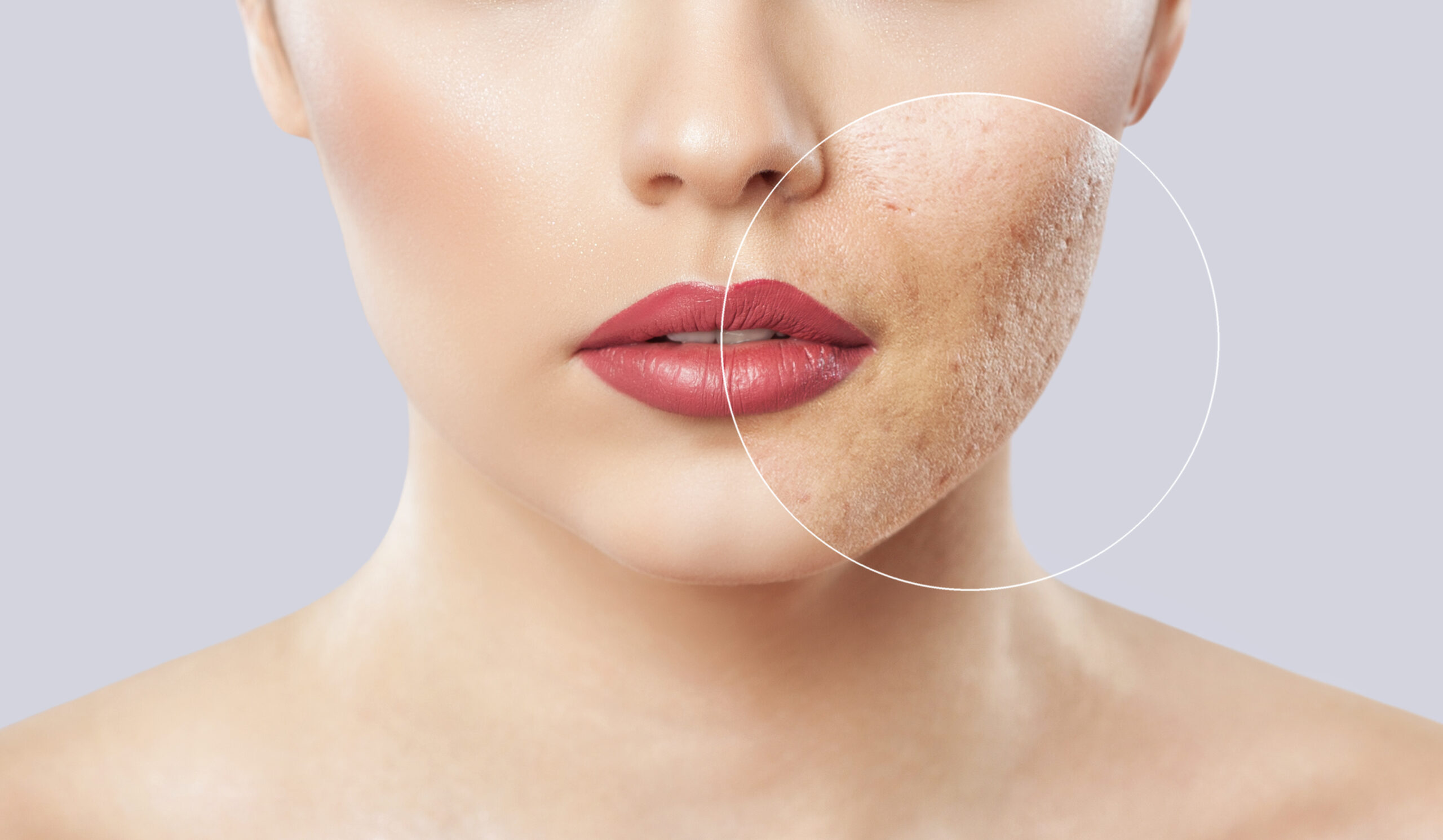 A,Young,Girl,With,A,Problem,Skin.,Photo,Before,And