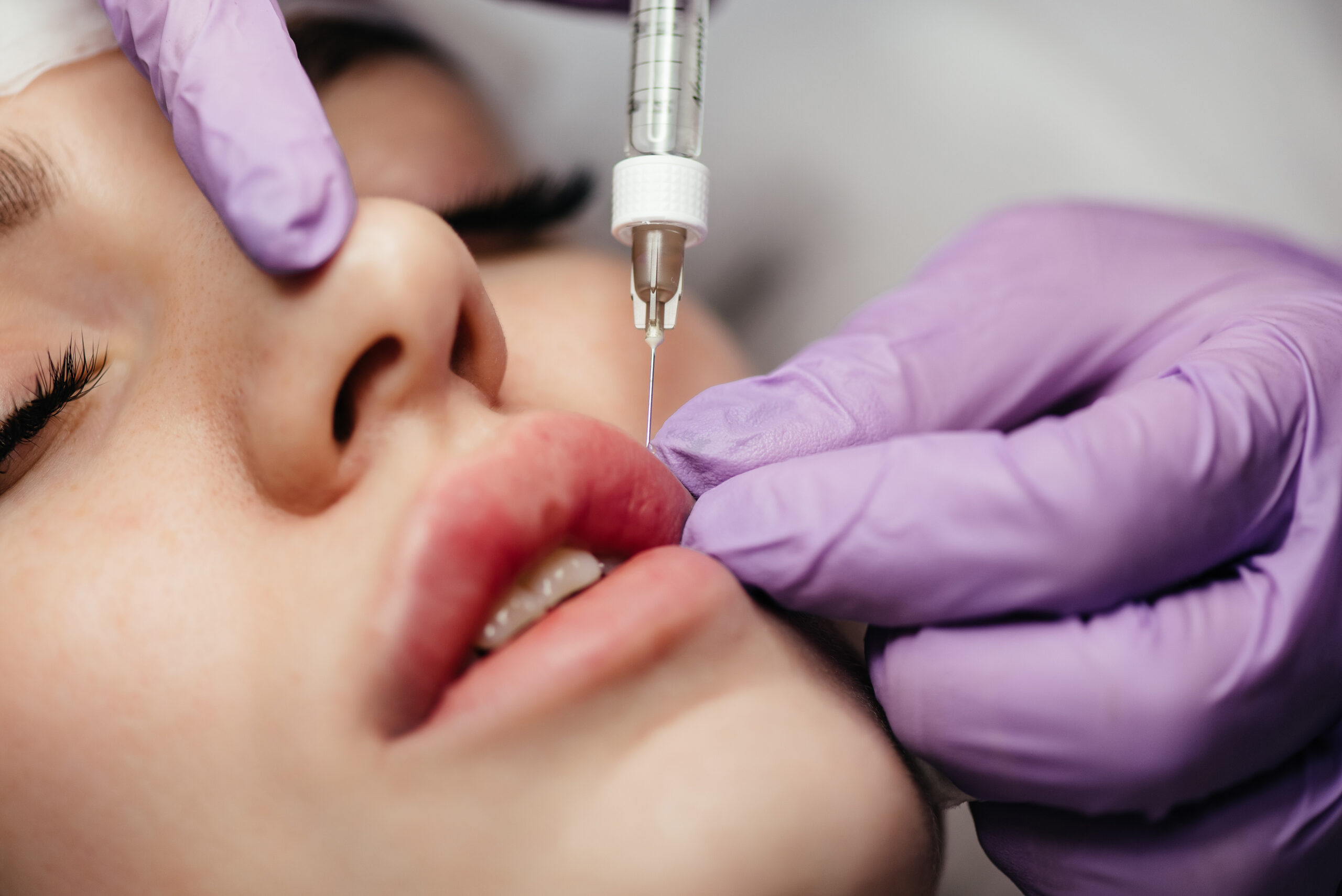Injections of the lips. Adjustment of the lower lip form. Injection of beauty.